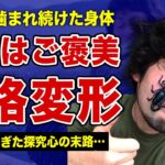 平坂寛が毒虫に噛まれ続ける本当の理由…普通の痛みでは満足できない”マゾヒズム”の実態に言葉を失う…！リアル”モンスターハンター”の身体に起こった異変…致死量の毒に蝕まれすぎてしまった末路に一同驚愕！