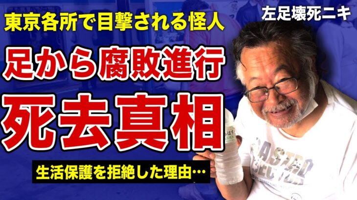 左足壊死ニキが自ら命を絶った真相…生活保護を拒否しホームレス生活を続けていた理由に言葉を失う！腐って肥大化した足に巻きつけられたビニール袋の中身の実態…ウジ虫に侵食されながら放置した末路に一同驚愕！